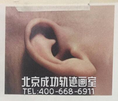 耳朵示例图